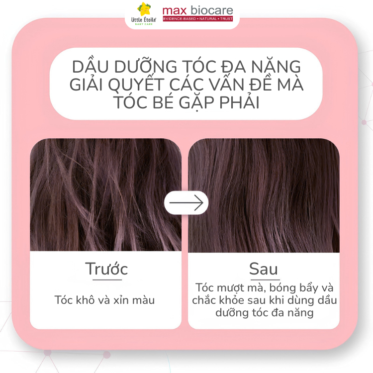 Dầu dưỡng tóc Little Étoile Baby Care Úc đa năng 4 trong 1 cho bé