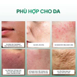Tế Bào Gốc Chống Lão Hóa, Xử Lý Sẹo Rỗ GSC Anti Ageing Ampoule Tăng Sinh Collagen, Phục Hồi Da Peel 10ml - GB023A — ảnh 8