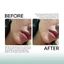 Tế Bào Gốc Chống Lão Hóa, Xử Lý Sẹo Rỗ GSC Anti Ageing Ampoule Tăng Sinh Collagen, Phục Hồi Da Peel 10ml - GB023A