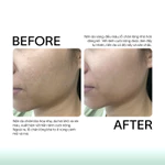 Tế Bào Gốc Chống Lão Hóa, Xử Lý Sẹo Rỗ GSC Anti Ageing Ampoule Tăng Sinh Collagen, Phục Hồi Da Peel 10ml - GB023A — ảnh 6