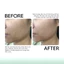 Tế Bào Gốc Chống Lão Hóa, Xử Lý Sẹo Rỗ GSC Anti Ageing Ampoule Tăng Sinh Collagen, Phục Hồi Da Peel 10ml - GB023A