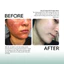 Tế Bào Gốc Chống Lão Hóa, Xử Lý Sẹo Rỗ GSC Anti Ageing Ampoule Tăng Sinh Collagen, Phục Hồi Da Peel 10ml - GB023A