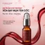 Serum giảm mụn Camellia H hỗ trợ giảm mụn dưỡng da mềm mịn
