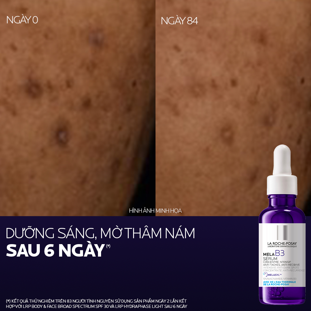 Dưỡng chất giảm thâm nám và dưỡng sáng toàn diện La Roche-Posay Mela B3 serum 30ml | BigBuy360 - bigbuy360.vn