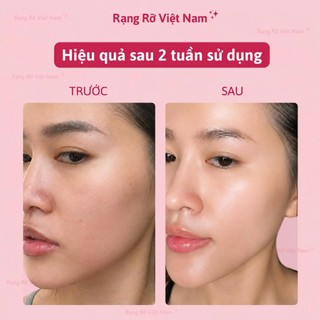 Guasha Thép Không Gỉ Cao Cấp Kèm Cây Lăn Thép Massage Thon Gọn Mặt Giảm Mệt Mỏi Stress Săn Chắc Da - Bộ Massage Thép