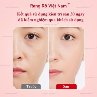 Bộ Massage Nâng Cơ Mặt Bằng Đá Giúp Giảm Nếp Nhăn , Chống Lão Hóa, Trẻ Hóa Làn Da Hiệu Quả - Miếng Đá Guasha Trong Suốt