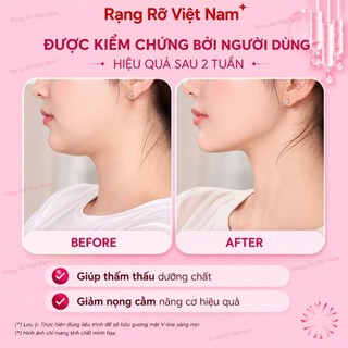 Bộ Đá Guasha Massage Mặt Giảm Nếp Nhăn + Cây Lăn Massage Nâng Cơ Bằng Đá Tự Nhiên Màu Trắng Xanh - Đá Mã Não Tự Nhiên