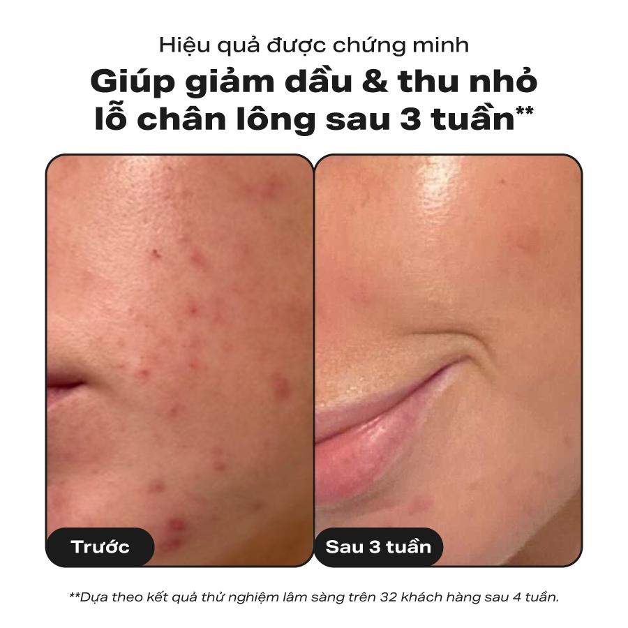 Bộ đôi thu nhỏ lỗ chân lông Paula's Choice Clinical Niacinamide 20% , Skin Perfecting 2% BHA Liquid Mã 8030-2010 | BigBuy360 - bigbuy360.vn