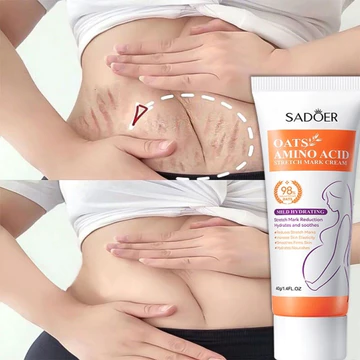 Kem trị vết rạn dành cho bà bầu 40g, phù hợp cải thiện vết rạn đỏ, trắng, vết sẹo thai kỳ, giúp làm mờ vết rạn da.
