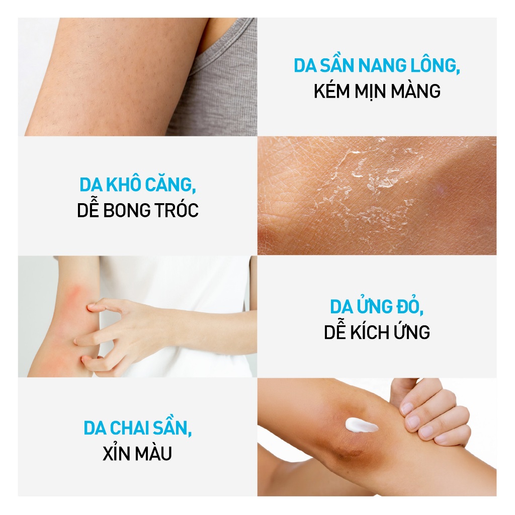 Kem dưỡng hỗ trợ giảm thô ráp, nứt nẻ và dưỡng ẩm cho da Dr.PONG U9.9 RENEWAL CREAM | BigBuy360 - bigbuy360.vn