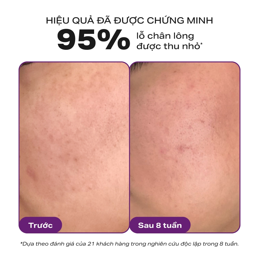 Bộ đôi thu nhỏ lỗ chân lông Paula's Choice Clinical Niacinamide 20% , Skin Perfecting 2% BHA Liquid Mã 8030-2010 | BigBuy360 - bigbuy360.vn
