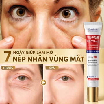 Kem dưỡng mắt Nhật Bản Kem mắt thâm mắt kem dưỡng mắt Kem chống nhăn vùng mắt xóa bọng mắt chống lão hóa