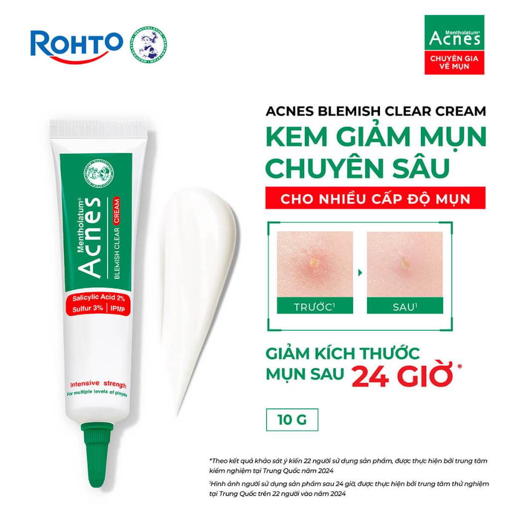 Kem chấm mụn chuyên sâu Acnes Blemish Clear Cream 10g