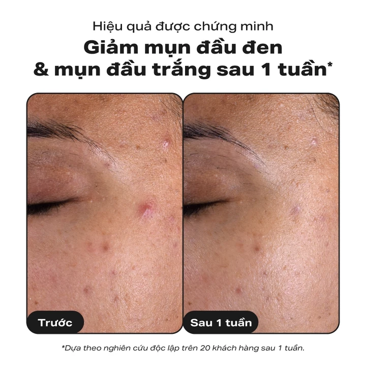 Acne Dermocosmetics Paula's Choice Skin – 30 ml – 4