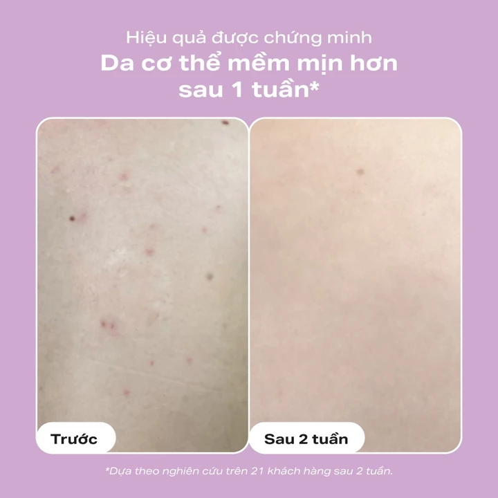 Moisturizer AHA – 5