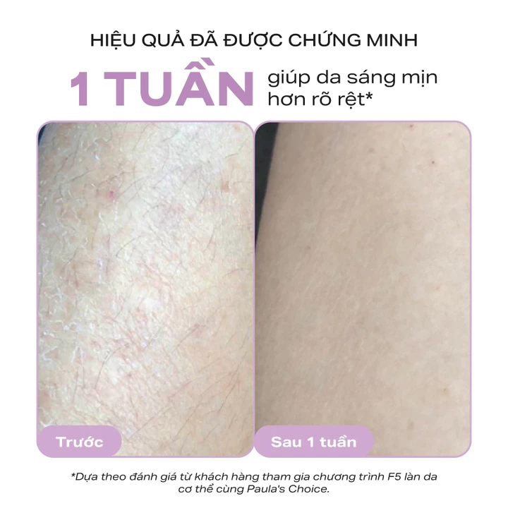 Moisturizer AHA – 7