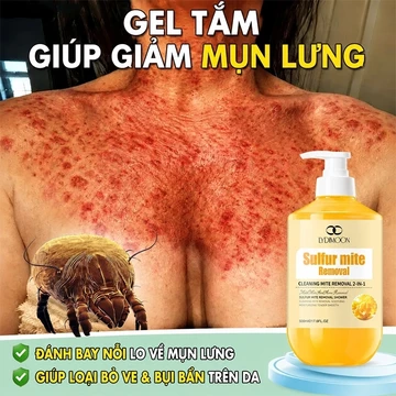 Sữa tắm mụn lưng Sữa tắm lưu huỳnh sữa tắm trắng 500ml Loại bỏ mụn trứng cá và ve ngứa Làm mới kiểm soát dầu