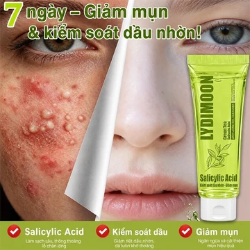 Sữa rửa mặt mụn sữa rửa mặt da dầu sữa rửa mặt trắng da 100g sữa rửa mặt da dầu mụn Dầu Kiểm Soát Mụn Làm Trắng Dưỡng Ẩm