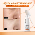 Bộ Sản Phẩm Dưỡng Sáng Mờ Nám Hỗ Trợ Làm Trắng Da Chuyên Sâu Cho Da Lão Hóa (Serum + Kem Dưỡng Vitamin C + Viên uống) — ảnh 4