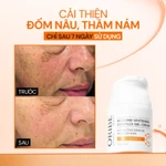 Bộ Sản Phẩm Dưỡng Sáng Mờ Nám Hỗ Trợ Làm Trắng Da Chuyên Sâu Cho Da Lão Hóa (Serum + Kem Dưỡng Vitamin C + Viên uống) — ảnh 5