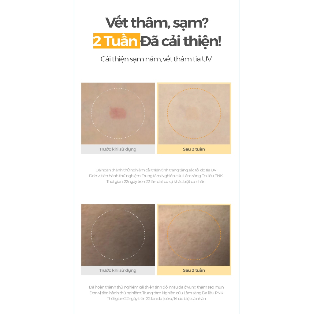 Serum trẻ hoá phục hồi da lão hoá sạm nám, LCL to Deepondé Glutathione Toning Ampoule Deeponde 30ml - Serum Dưỡng Sáng | BigBuy360 - bigbuy360.vn