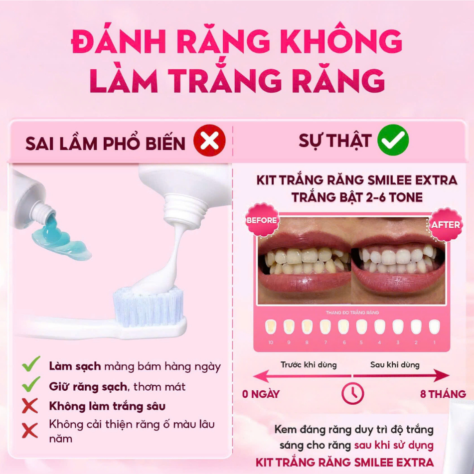 [GIÁ 631K TẠI LIVE SHOP] Trắng răng SMILEE EXTRA, bộ kit làm trắng răng từ 2-6 tone tại nhà, bộ quà tặng cho nữ, LIS | BigBuy360 - bigbuy360.vn