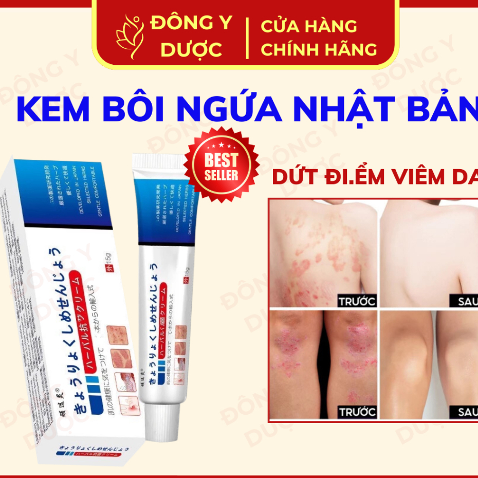 Kem Bôi Viêm Da Cơ Địa NHẬT BẢN Hiragana Kem Bôi Nấm Ngứa Hỗ Trợ Dứt Điểm Hắc Lào Tổ Đỉa, Á Sừng