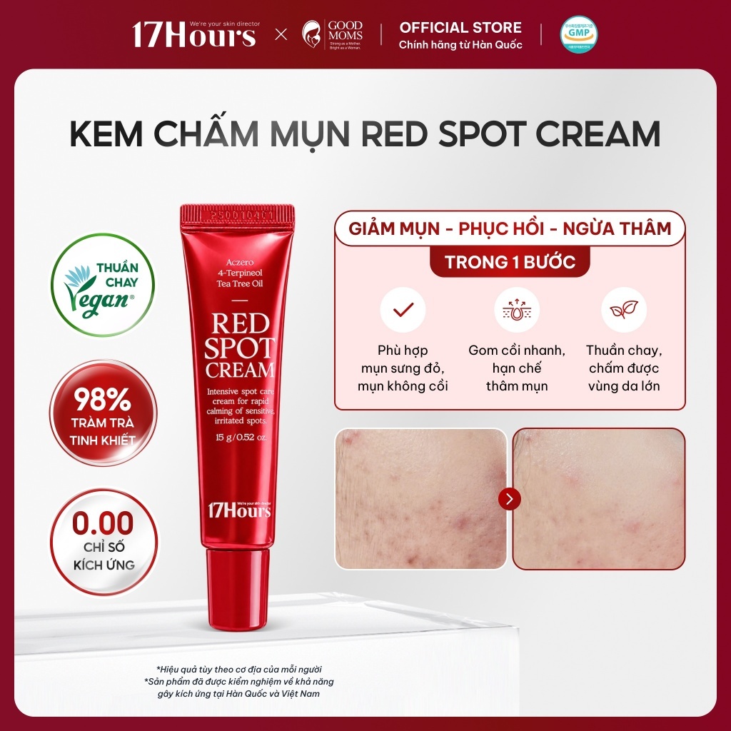 Kem Chấm Mụn 17Hours Red Spot Cream 15g Thuần Chay, chiết xuất tràm trà, dịu mụn sưng viêm, gom cồi nhanh, ngừa thâm mụn