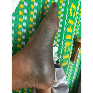 KANSA WAND_CÂY LĂN MASSAGE MẶT BẰNG ĐỒNG NÂNG CƠ TRẺ HÓA , ĐẢ THÔNG KINH LẠC (NHẬP KHẨU ẤN ĐỘ )