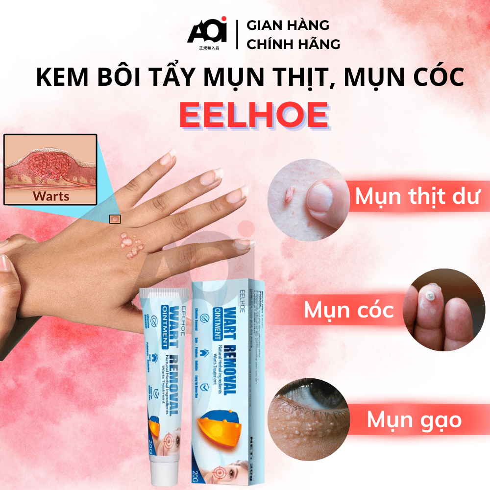 KEM BÔI TẨY MỤN THỊT MỤN CÓC EELHOE WART REMOVAL 20G, LOẠI BỎ MỤN GẠO MỤN CƠM U NHÚ, LÀM KHÔ DA SẦN SÙI AN TOÀN AOI SHOP
