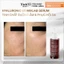 Sample tinh chất cấp ẩm phục hồi Ekseption Hyaluronic B5 Mixlab serum 4ml