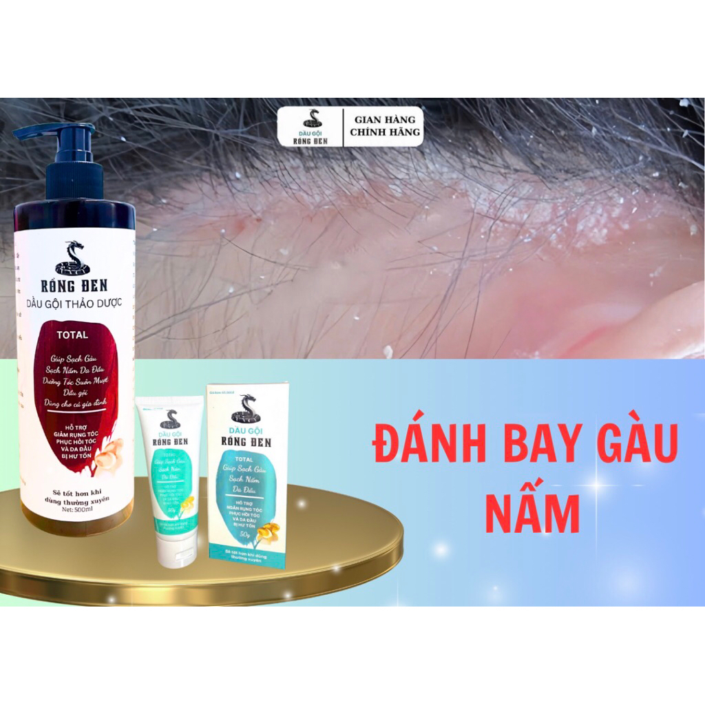 Giảm 40%  Dầu Gội Thảo Dược RồngĐen Giúp Sạch gàu viêm da cơ địa giúp tóc chắc khoẻ mềm mượt