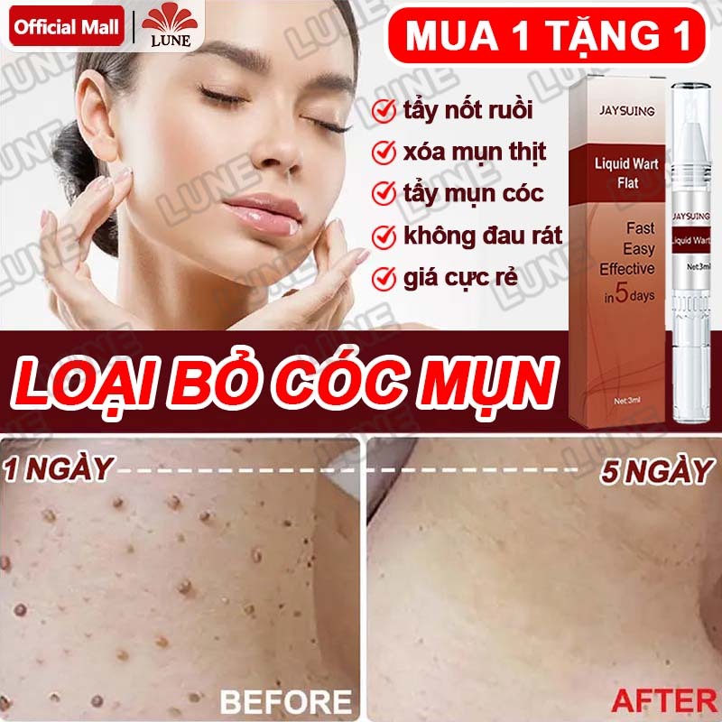 Bút Tẩy Nốt Ruồi, Xóa Mụn Thịt, Tẩy Mụn Cóc, Kem tẩy mụn cóc Tẩy nốt ruồi 7 ngày, không đau rát, thành phần thiên