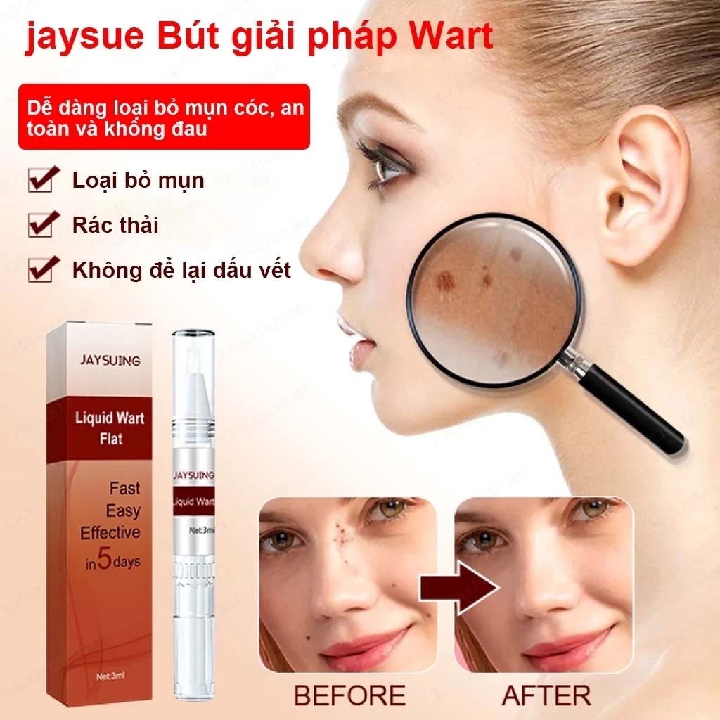 Bút Tẩy Nốt Ruồi, Xóa Mụn Thịt, Tẩy Mụn Cóc, Kem tẩy mụn cóc Tẩy nốt ruồi 7 ngày, không đau rát, thành phần thiên