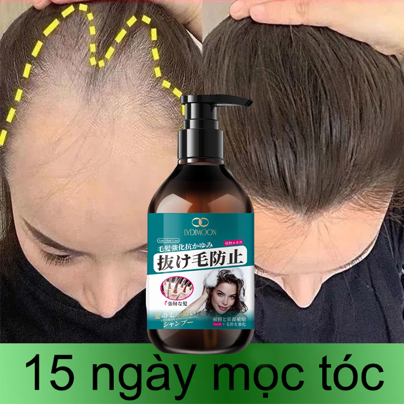 Dầu Gội Chăm Sóc Tóc Và Da Đầu - Hình ảnh thực tế