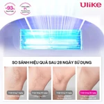 [LIVE] Máy triệt lông Ulike Air 3 công nghệ làm mát Ice Cooling IPL Sapphire  - Hàng Chính Hãng - Bảo hành 24 tháng — ảnh 8
