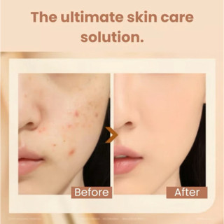 Kem Nền Shiroada Stick Foundation Chính Hãng, Che Khuyết Điểm, Che Quầng Thâm, Dưỡng Ẩm, Lớp Nền Mịn