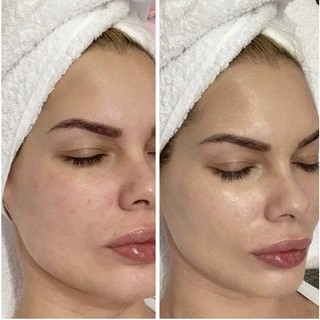 Tinh chất HA Tăng Cường Độ Ẩm Da Christina Theraskin + HA Concentrate Line Repair 50ml/100ml
