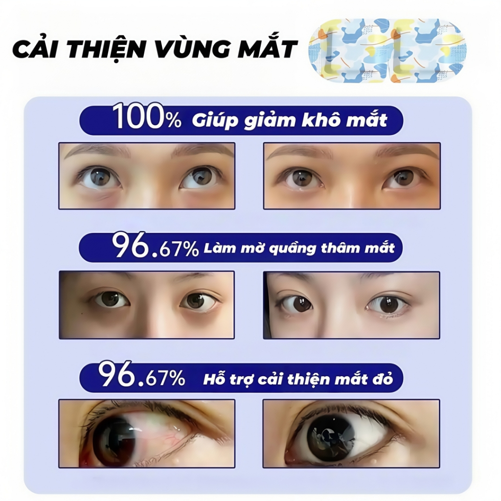 Sử dụng Cái Mặt Nạ Mắt Giữ Nhiệtrong đời sống