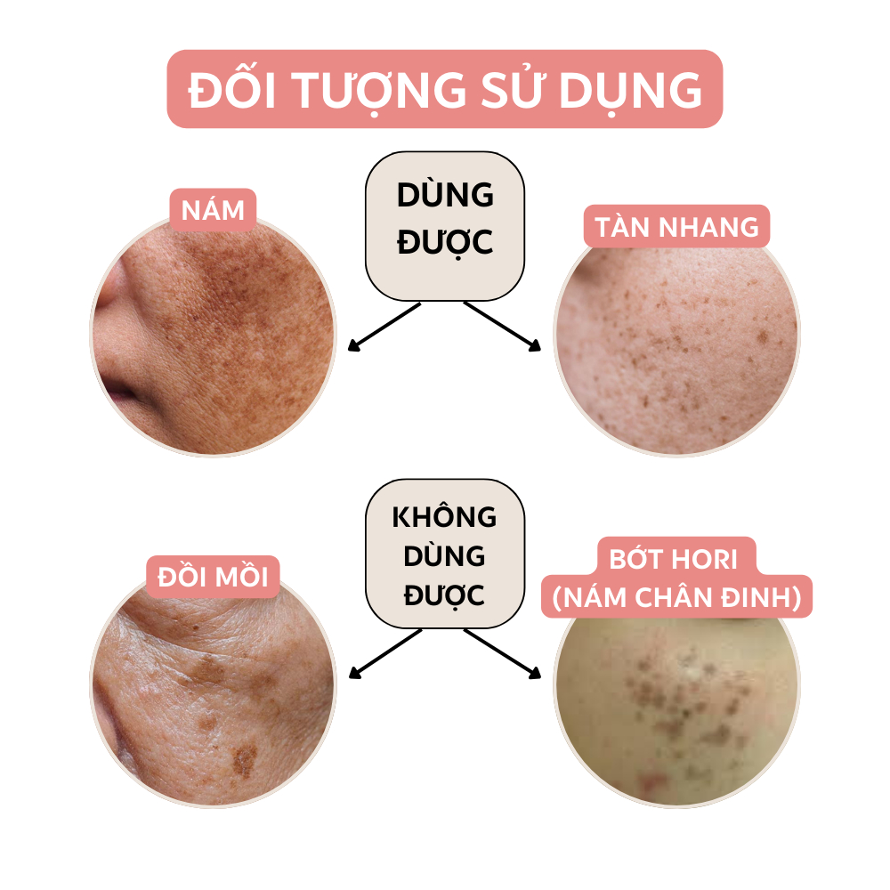 Serum Nám Da Tàn Nhang ARDAN 20ml - Hiệu Quả Mờ Nám Tàn Nhang Nhanh Chóng