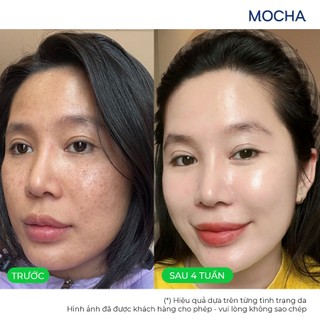 Combo Giảm Sạm Nám Chuyên Sâu MOCHA Smart Brightening Cream và Smart First Care Serum, Mua 2 Tặng 2