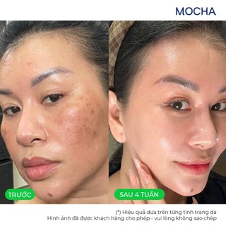 Kem Giảm Nám Mocha 6in1 Đa Tầng, Cải Thiện Sạm Nám Smart Brightening Cream 30gr