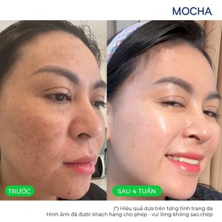 Serum Giảm Nám Mocha Dưỡng Sáng Da,Cải Thiện Đốm Nâu, Smart First Care Serum 30ml