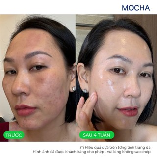 Serum Giảm Nám Mocha Dưỡng Sáng Da,Cải Thiện Đốm Nâu, Smart First Care Serum 30ml