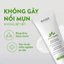 Kem Dưỡng BABE Stop AKN Mattifying Moisturiser cho da dầu giảm mụn 50ml
