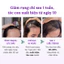 SERUM KÍCH MỌC TÓC NHANH DÀI, Ngăn Rụng Tóc, Hói Đầu, Dưỡng Tóc Dày, Dài, Khoẻ ZZ3