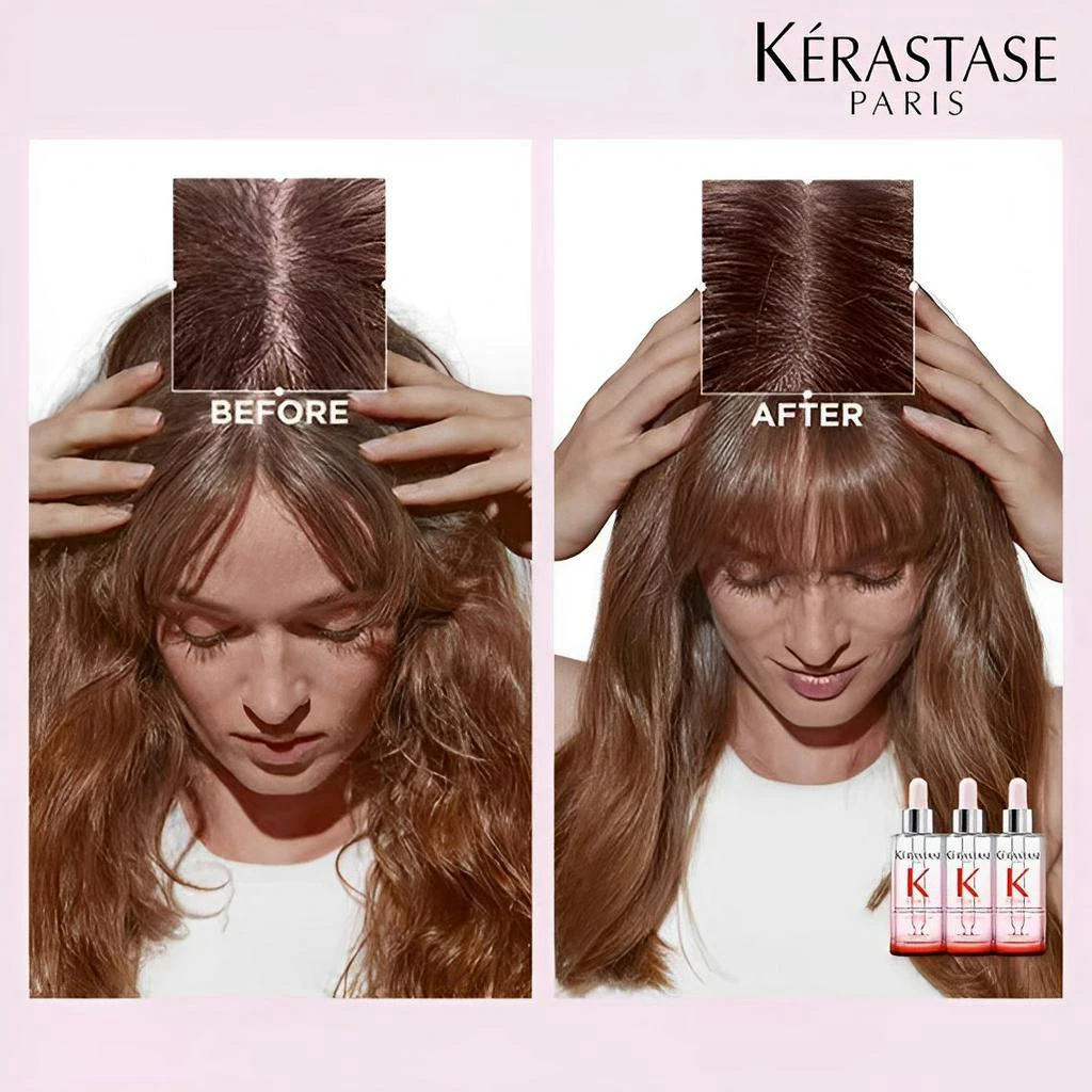 Kerastase Anti Hair Fall Serum Rambut Rontok Genesis 30ML/Anti Dandruff Serum/Scalp Balancing Serum