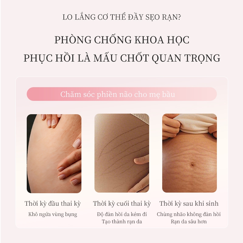 Kem Phục Hồi Rạn Da Dưỡng Ẩm 120g Hỗ trợ cải thiện thâm Rạn da cho mẹ bầu sau sinh Do tăng cân