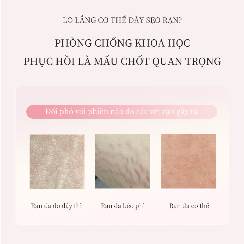 Kem Phục Hồi Rạn Da Dưỡng Ẩm 120g Hỗ trợ cải thiện thâm Rạn da cho mẹ bầu sau sinh Do tăng cân