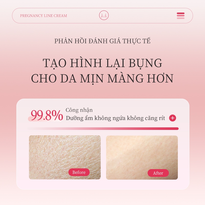 Kem Phục Hồi Rạn Da Dưỡng Ẩm 120g Hỗ trợ cải thiện thâm Rạn da cho mẹ bầu sau sinh Do tăng cân